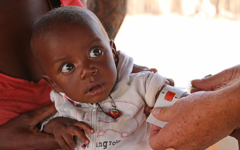An Angolese baby has his arm measured at a health clinic