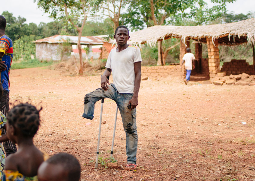 A young man who lost his right leg stands with his crutch in the middle of his village.