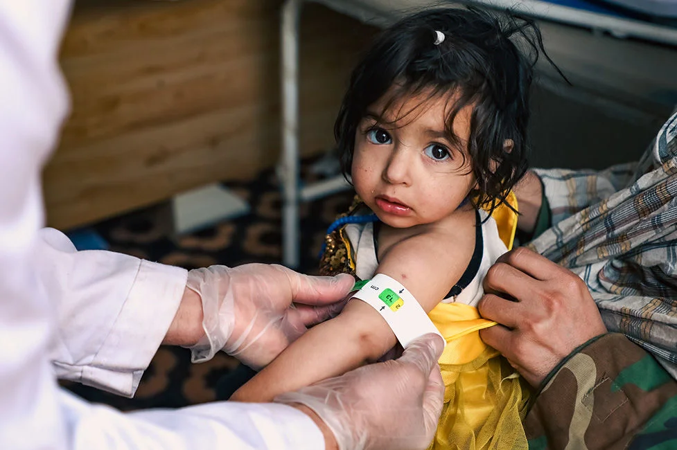 A health worker uses a mid-upper arm circumference (MUAC) tape to determine if the child suffers from malnutrition.