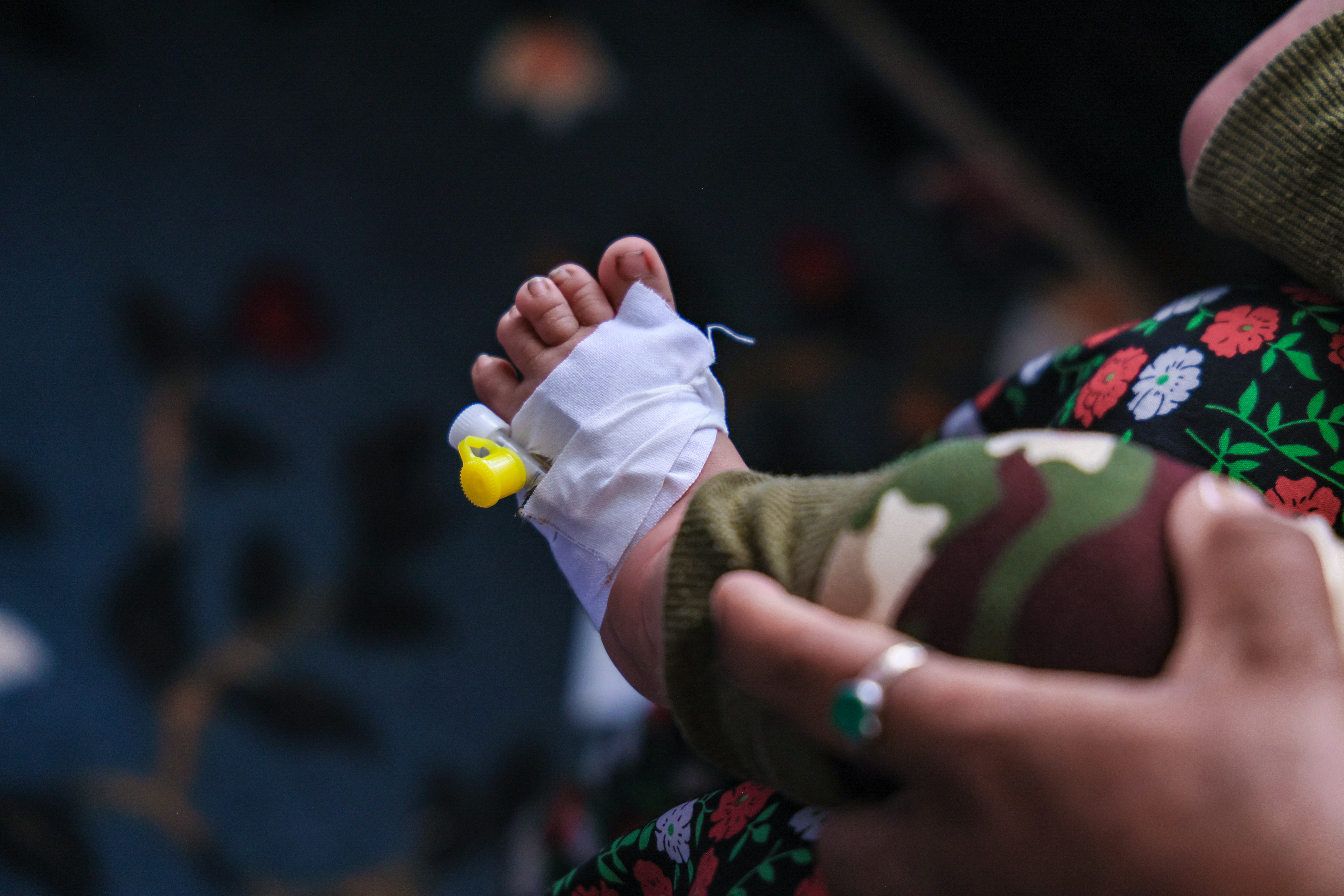 Foot of a sick child who brought by his mother to an ABC clinic in Ghor due to his diarrhea disease.