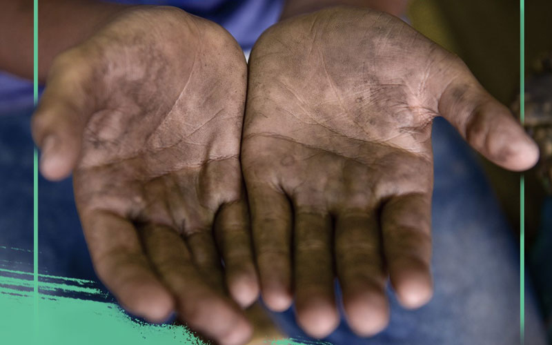 A pair of open palms of a child labourer with dirt, tough marks, and scars.